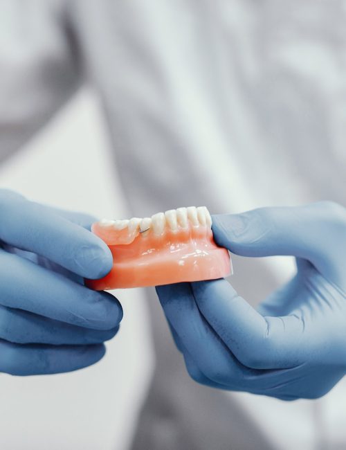 Plastic jaw in the dentist's office. The doctor holds in the hands of dental implants.